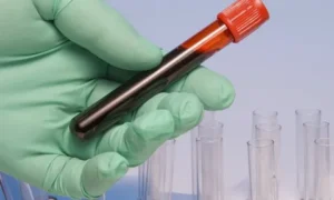 Колба с кровью