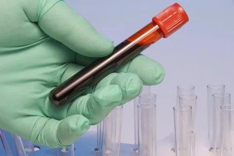 Колба с кровью