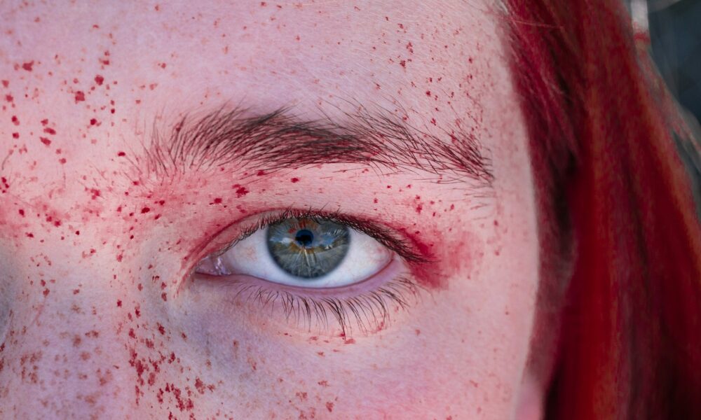 Лицо с краснотой