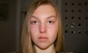 Девушка без макияжа