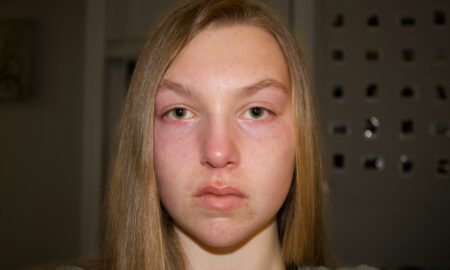 Девушка без макияжа
