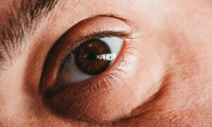 Девушка с отеком