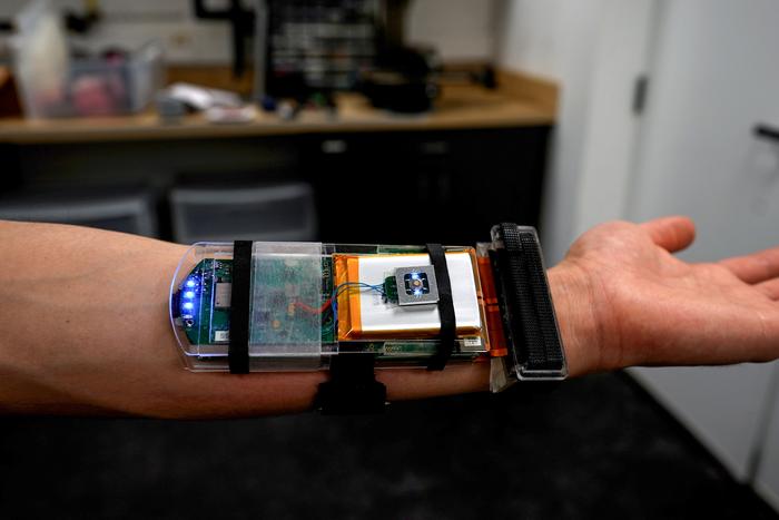 Американские физики разработали браслет, который отслеживает движения пальцев и суставов кистей рук