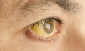 Желтый глаз