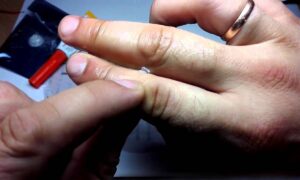 Суперклей на пальцах