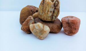 Камни в почках