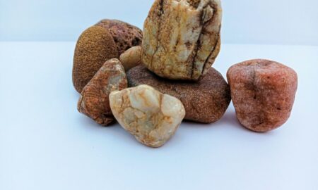 Камни в почках