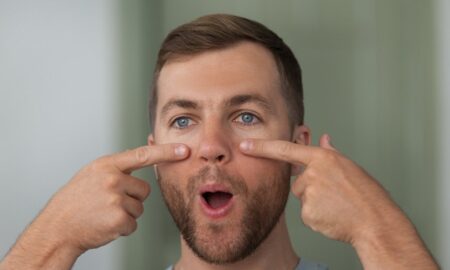 опухшие глаза