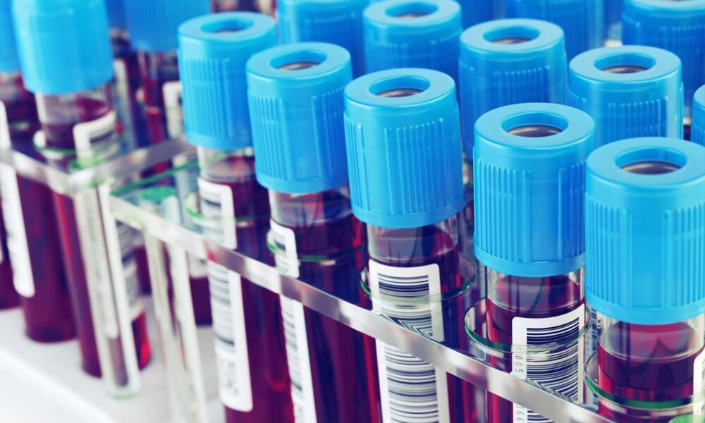 Кровь в пробирке