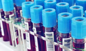 Кровь в пробирке