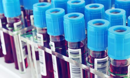 Кровь в пробирке